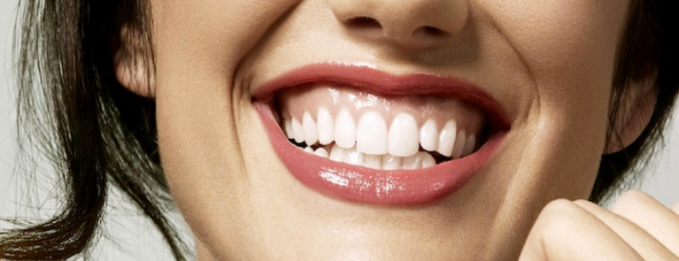 Mulher sorrindo | Gengivite: causas e tratamentos