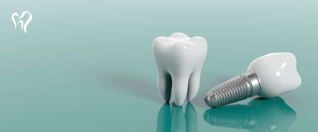 implante dentário