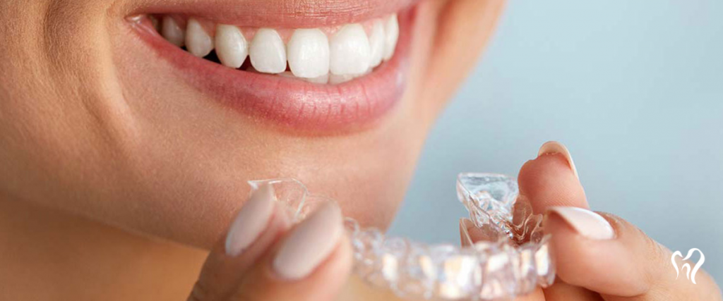 Invisalign