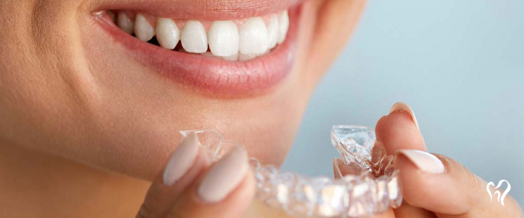 Invisalign: Tudo sobre este tratamento que revoluciona a ortodonta!